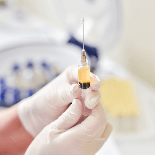 PRP Under-Eye Treatment Series 